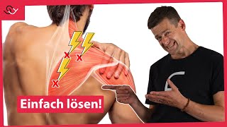 Schulterblattschmerzen loswerden und Schulter zentrieren  Mit diesem Trick [upl. by Shaff735]