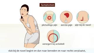 Blindedarmontsteking  Symptomen en operatie [upl. by Gifford]