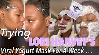 USING GREEK YOGURT AS A MASK On My Face For 5 DAYS [upl. by Hyman]