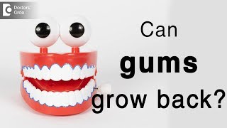 Gingival recession causes treatment  Can gums grow back Dr MR Pujari [upl. by Keifer]