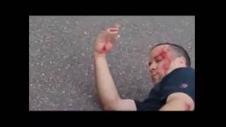 skateboard fail compilation 2016 broken bones and bleeding [upl. by Bettzel]