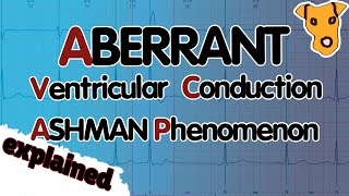 ABERRANT VENTRICULAR CONDUCTION Ashman Phenomenon Explained [upl. by Ellierim]