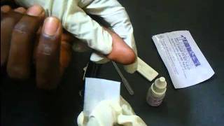 HIV Antibody Test Using a Rapidcard [upl. by Epillihp]