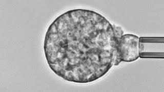 Human neutrophil versus Coccidioides cause of Valley fever Chemotaxis adhesion and phagocytosis [upl. by Louanna439]