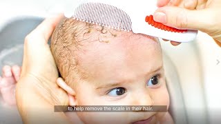 4 cradle cap tips from dermatologists [upl. by Woehick]