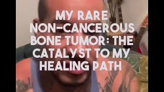 My Rare NonCancerous Bone Tumor The Catalyst to My Healing Path [upl. by Wagstaff825]