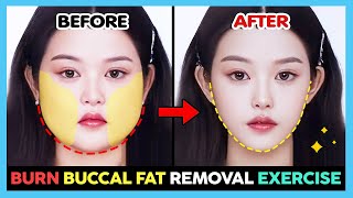 ✨ BURN BUCCAL FAT REMOVAL EXERCISE amp MASSAGE  Cheek fat loss Cheek lift Face fat loss [upl. by Letniuq]