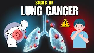 10 Lung Cancer Symptoms I Wish I Knew Sooner [upl. by Milissent934]