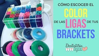 CÓMO ESCOGER EL COLOR DE LAS LIGAS DE TUS BRACKETS  How to choose the color of your braces [upl. by Ennoid]