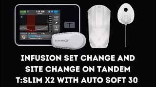 Infusion Set Change amp Site Change on Tandem tslim X2 with AutoSoft 30 [upl. by Ronyar]