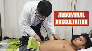 ABDOMINAL AUSCULTATION  Abdominal System Examination [upl. by Billy]