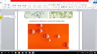 Nonsporeforming Gram positive Bacteria [upl. by Noryb]