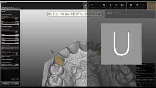 Workflow example from archive to nesting 2015 Modellier version  ZirkonzahnSoftware [upl. by Sybila]