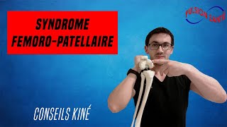 Soigner efficacement le syndrome fémoro patellaire  Conseil KINE et autoexercices [upl. by Ertha238]