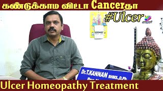 Ulcer கவனிக்காம விட்டா Cancerஆ மாறிடும்  Ulcer Homeopathy Treatment  Health Tips In Tamil  AnbuTv [upl. by Hussar]