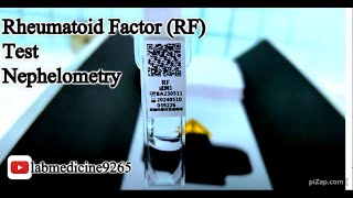 Rheumatoid Factor RF Test  Nephelometry  hiprobiotechnology8385 [upl. by Zebaj]