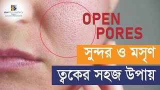 Treatments and Skin Care for Open Pores  Dr Tasnim Khan [upl. by Lontson]