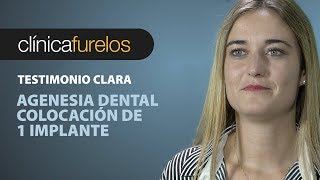 Clara  Agenesia dental [upl. by Elacsap]