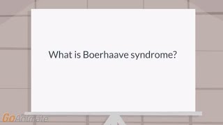 What is Boerhaave syndrome [upl. by Lav]