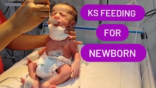 Ks Feeding Of Newborn In NICU With Proper Care  Newborn Feeding  Feeding Procedure new feed [upl. by Matthaeus]