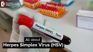 Herpes Simplex Virus HSV  Dr AV Lohit  Doctors Circle [upl. by Pearle112]