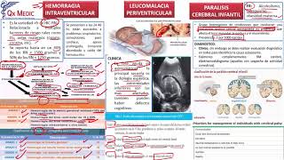 10 COMPLICACIONES LEUCOMALACIA PERIVENTR PARALISIS CEREBRAL INFANTIL [upl. by Whitson918]