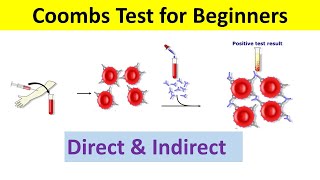 Coombs Test Principle Types Procedure Interpretation  Coombs test Direct and Indirect [upl. by Tallbott]