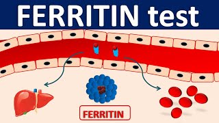 Serum Ferritin test  Its role in inflammation [upl. by Oretos]