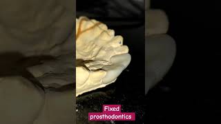 Fixed prosthodontics dentalcafe4331 [upl. by Yruok]