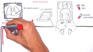 Acute Coronary Syndrome DETAILED Overview MI STEMI NSTEMI [upl. by Paige]