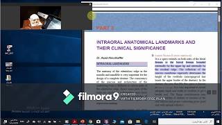 Limiting structures of maxillary arch part1part4 [upl. by Rtoip]