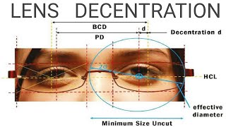 Lens Decentration  AK Khurana  Dr Saud Javed [upl. by Belinda228]