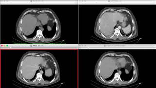 Introducción a los métodos TC y RM en abdomen y pelvis Repaso [upl. by Ellenig631]