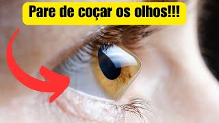 Os perigos de coçar os olhos descubra as consequências [upl. by Dygall607]