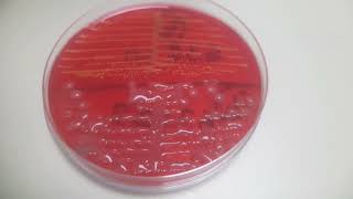 Klebsiella and Staphylococcus growth on CLED agar Uropathogens [upl. by Mcclimans]