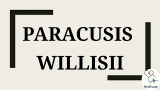 Paracusis Willisii [upl. by Leirum353]