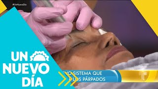 Fibroblast el tratamiento que te rejuvenece sin cirugías  Un Nuevo Día  Telemundo [upl. by Ocirnor]