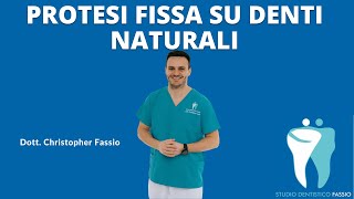 Protesi fissa su denti naturali [upl. by Ojadnama]