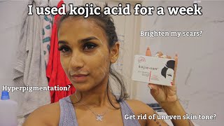 I Used Kojic Acid For A Week amp This Happened  Kojie San Review [upl. by Dloraj]