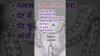 Rectal cancer symptomsरेक्टल कैंसर के लक्षणमलाशय के कैंसर के लक्षण [upl. by Squire]