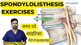 Spondylolisthesis Exercises  Spondylolisthesis physiotherapy treatment  L4L5 L5S1  Sciatica [upl. by Aerehs]