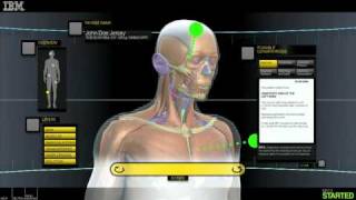 3D Medical Imaging [upl. by Lesak440]