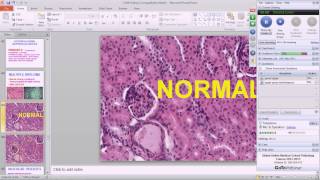 Medical School Pathology 2013 Season Session 19 Renal II [upl. by Hares]