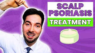 Scalp Psoriasis Removal and Best Treatment At Home [upl. by Dragde]