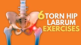 Top 6 Exercises For Naturally Healing A Painful Torn Hip Labrum [upl. by Ward]