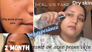 I tried 2 month COSRX Advanced Snail 96 Mucin Power Essence  Answers all your question [upl. by Culhert]