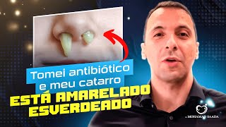 TOMEI ANTIBIÃ“TICO E MEU CATARRO CONTINUA AMARELADO E ESVERDEADO O QUE ESTÃ ACONTECENDO [upl. by Suirradal]