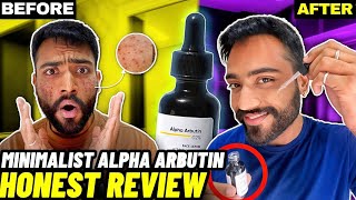 Best Serum For Dark Spots Minimalist ALPHA ARBUTIN Serum Review How to use Results Benefits [upl. by Eednas]