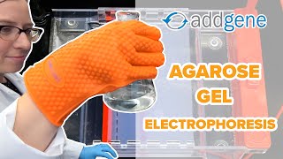 Agarose gel electrophoresis [upl. by Steven569]