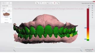 3Shape TRIOS Patient Monitoring [upl. by Anrahc862]